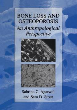 Bone Loss and Osteoporosis|Sabrina C. Agarwal