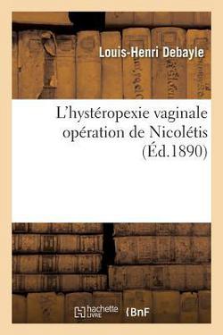 L'Hystéropexie Vaginale Opération de Nicolétis|Debayle