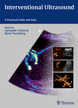 Interventional Ultrasound|Christoph Frank Dietrich